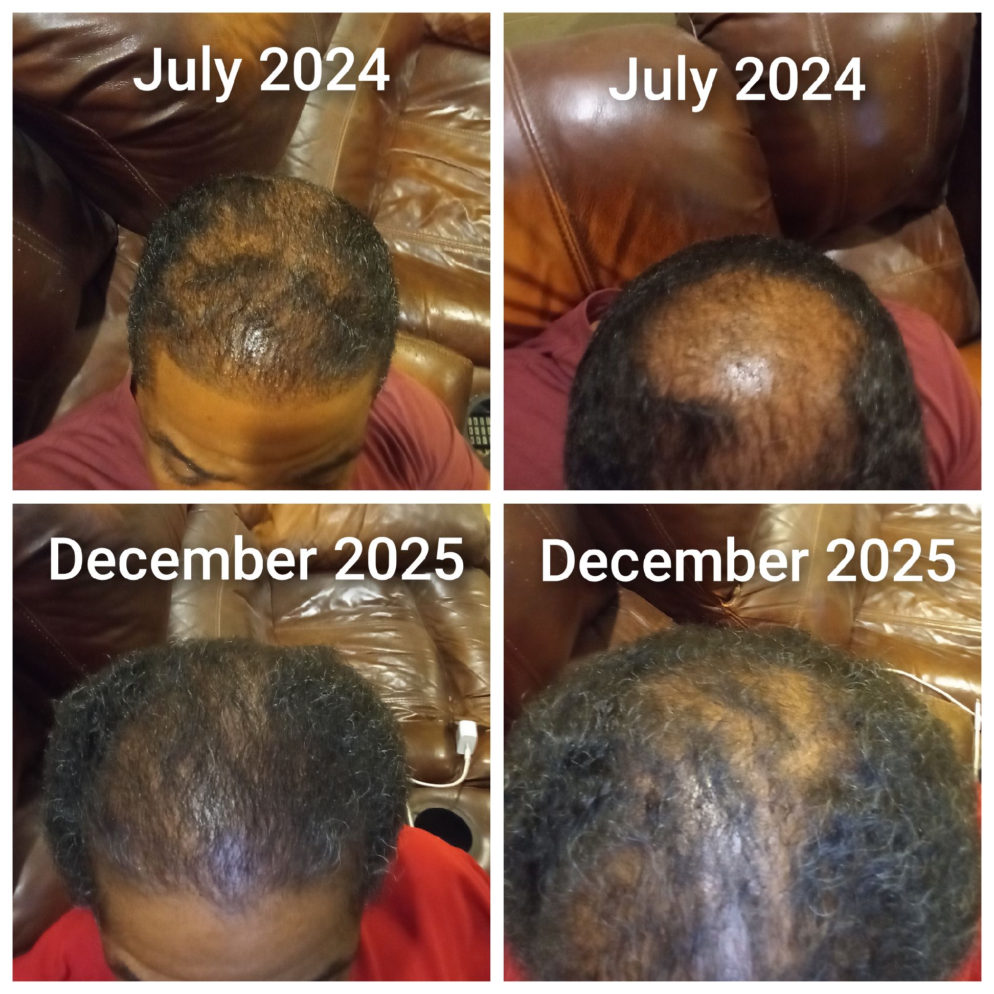 Dany D. - Before & After
